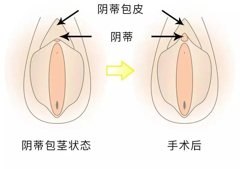 年龄越大，性生活时间就越短？想要延长时间，试试这几种方法