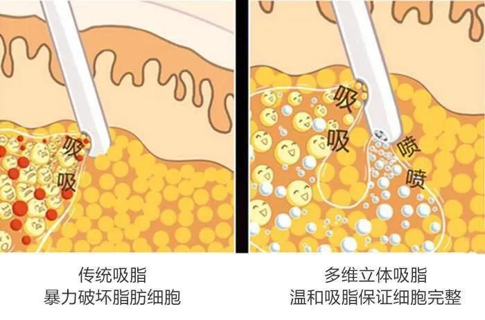 体检发现高密度脂蛋白下降。你知道它会带来什么危害吗？